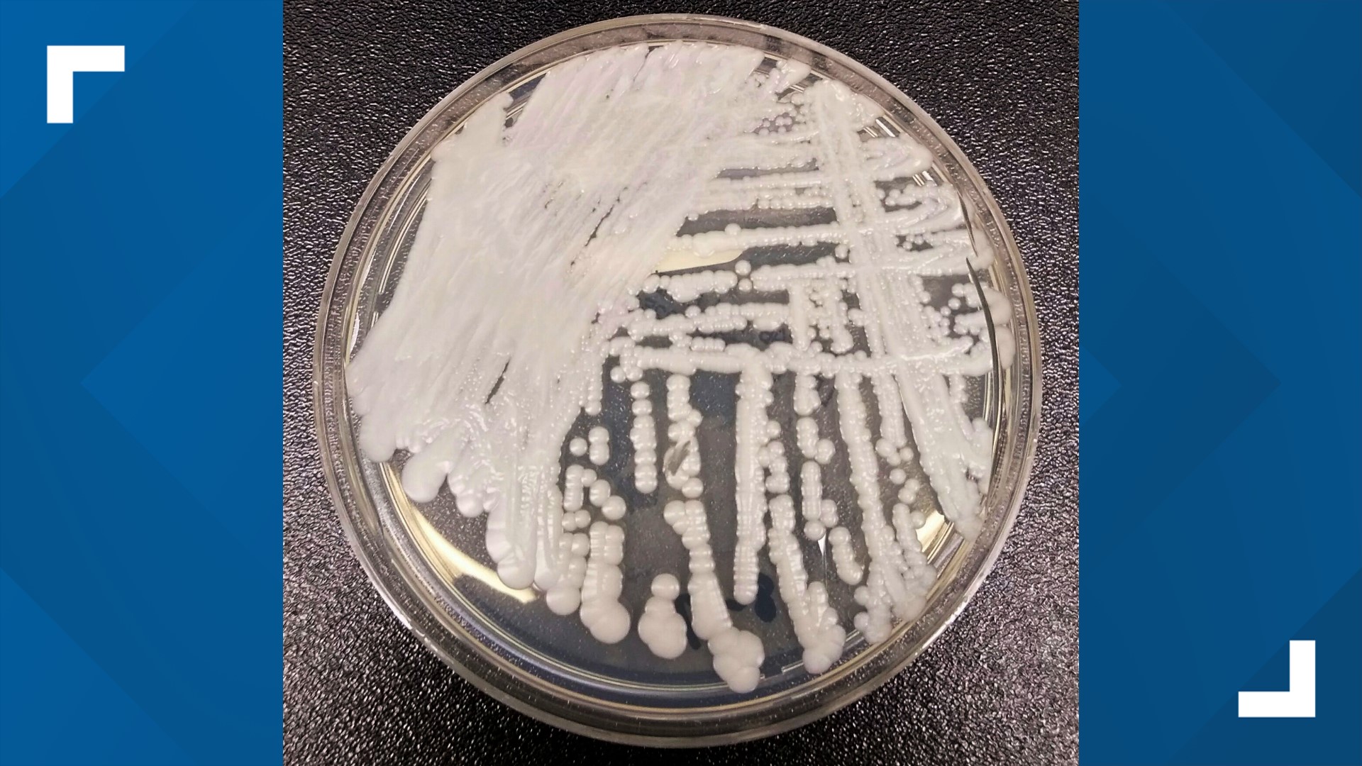 Candida Auris Drug Resistant Fungus Spreading In Us Cdc Says 4192