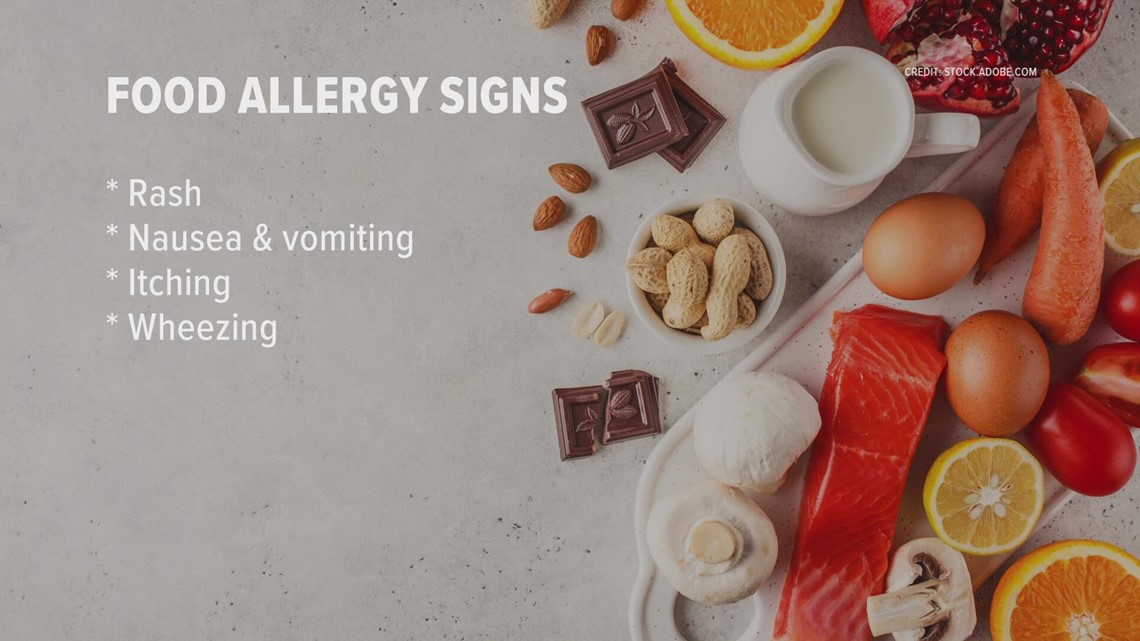 Navigating food allergies with your kids