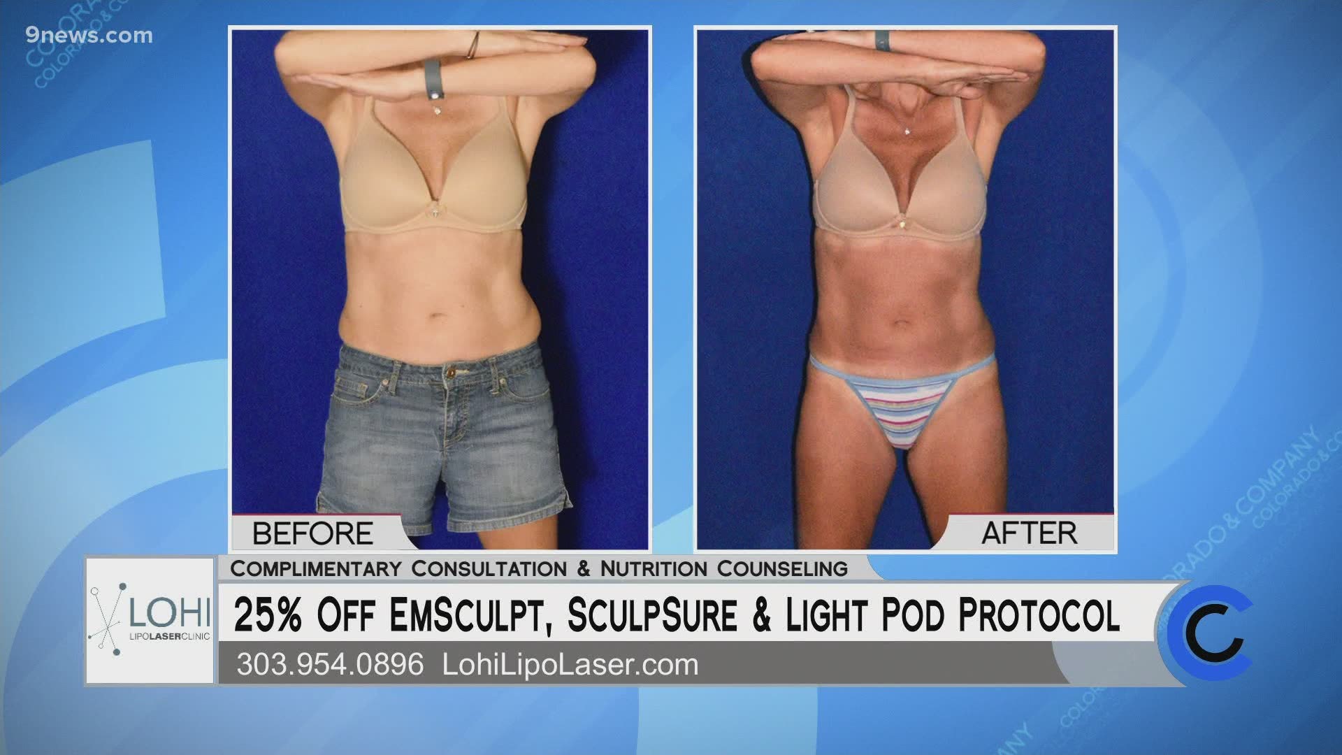 Right now you can get 25% off of 3 top technologies at Lohi Lipo Laser. Visit LohiLipoLaser.com or call 303.954.0896 to get started today.