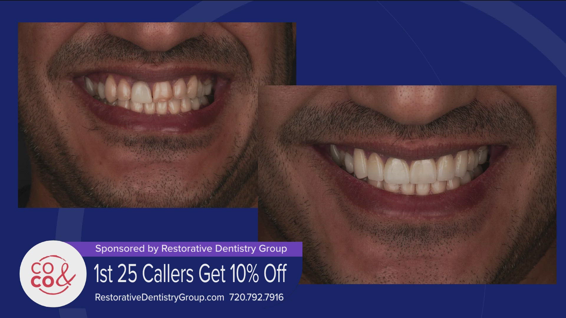 Restorative Dentistry Group uses the latest smile technologies and has a prosthodontist on staff. Call 720-792-7916 or go online RestorativeDentistryGroup.com.  PAID