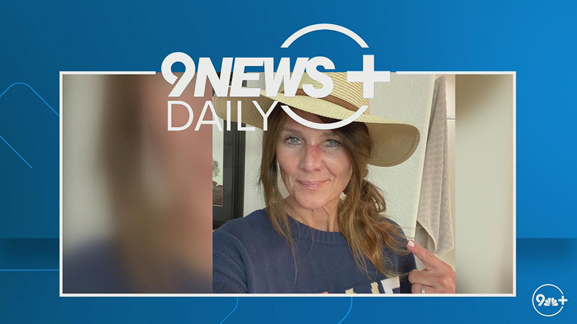 9NEWS Chief Meteorologist Kathy Sabine discusses her journey through a recent skin cancer diagnosis and surgery.