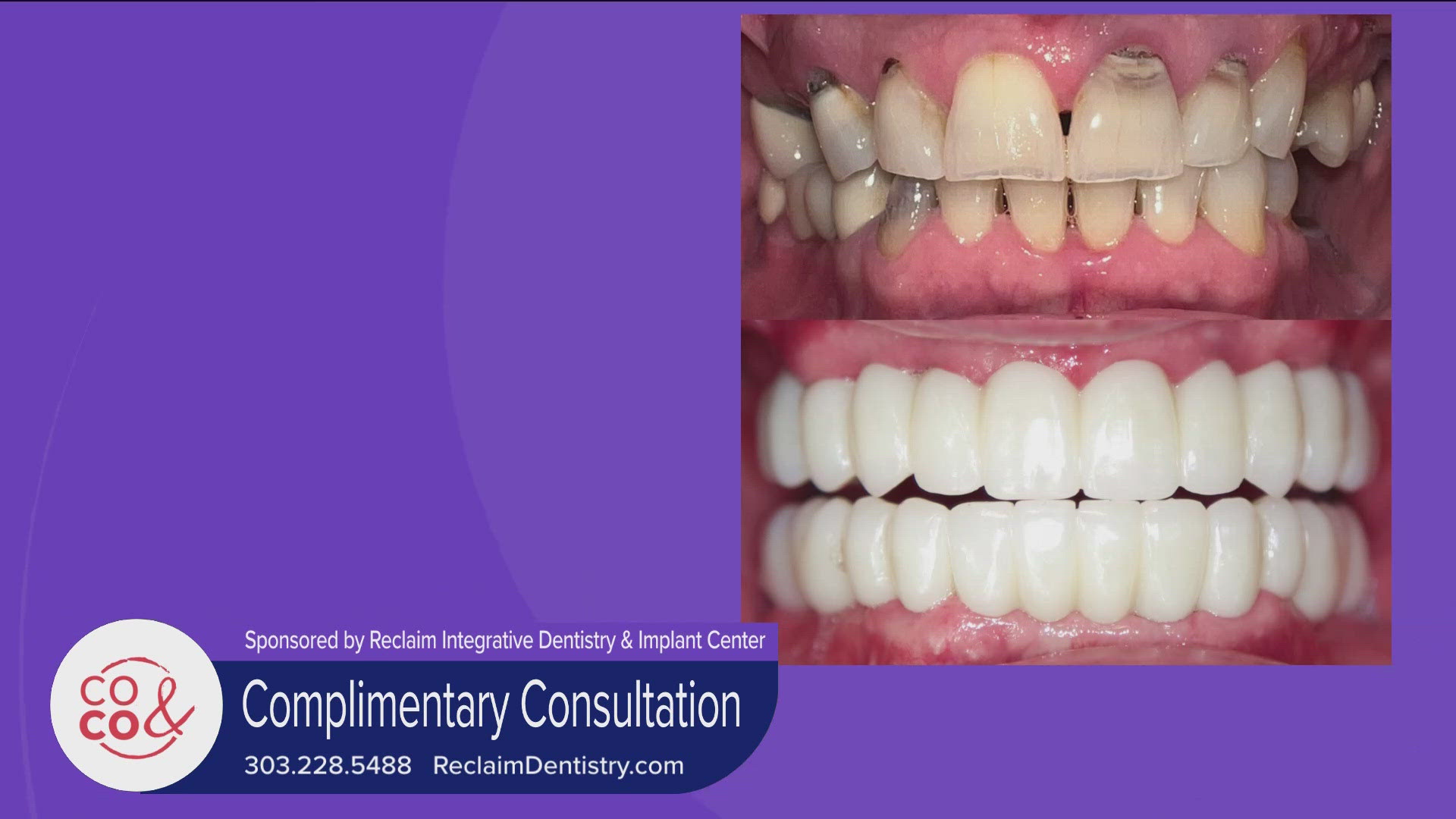 Call and book your complimentary consultation at 303.228.5488 or visit ReclaimDentistry.com. **PAID CONTENT**