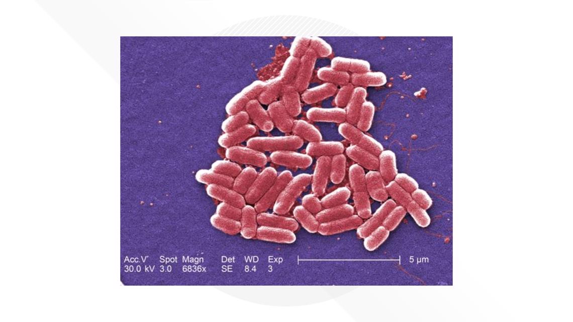 Do I Have E. Coli? 9NEWS Medical Experts Answers Common Questions ...