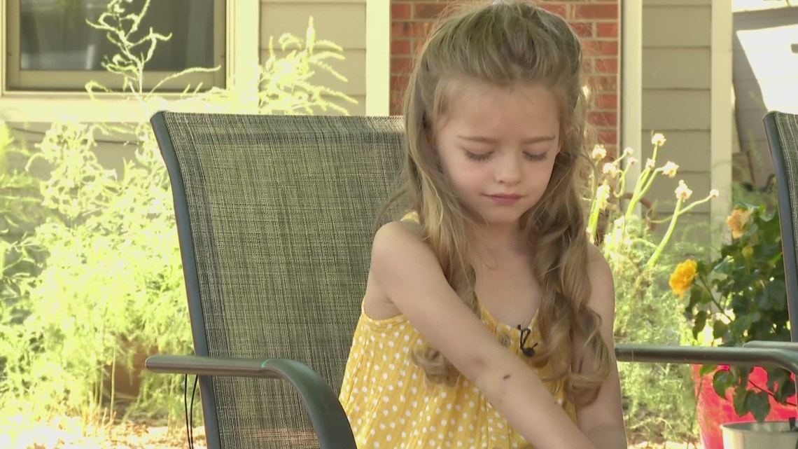 6-year-old girl recovering after dog attack in Fort Collins | 9news.com