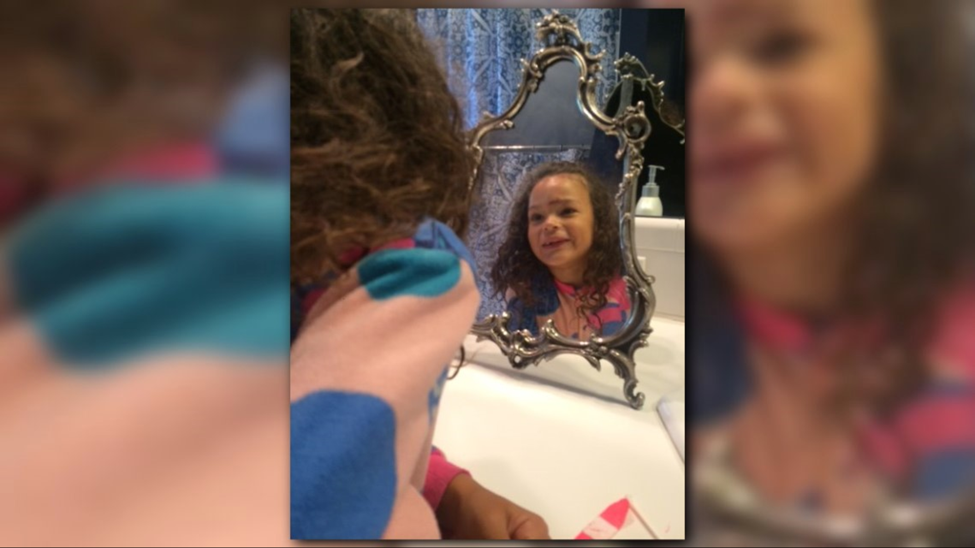 Ruby Scar Beautiful scars: Ruby Dee’s injury and her message | 9news.com