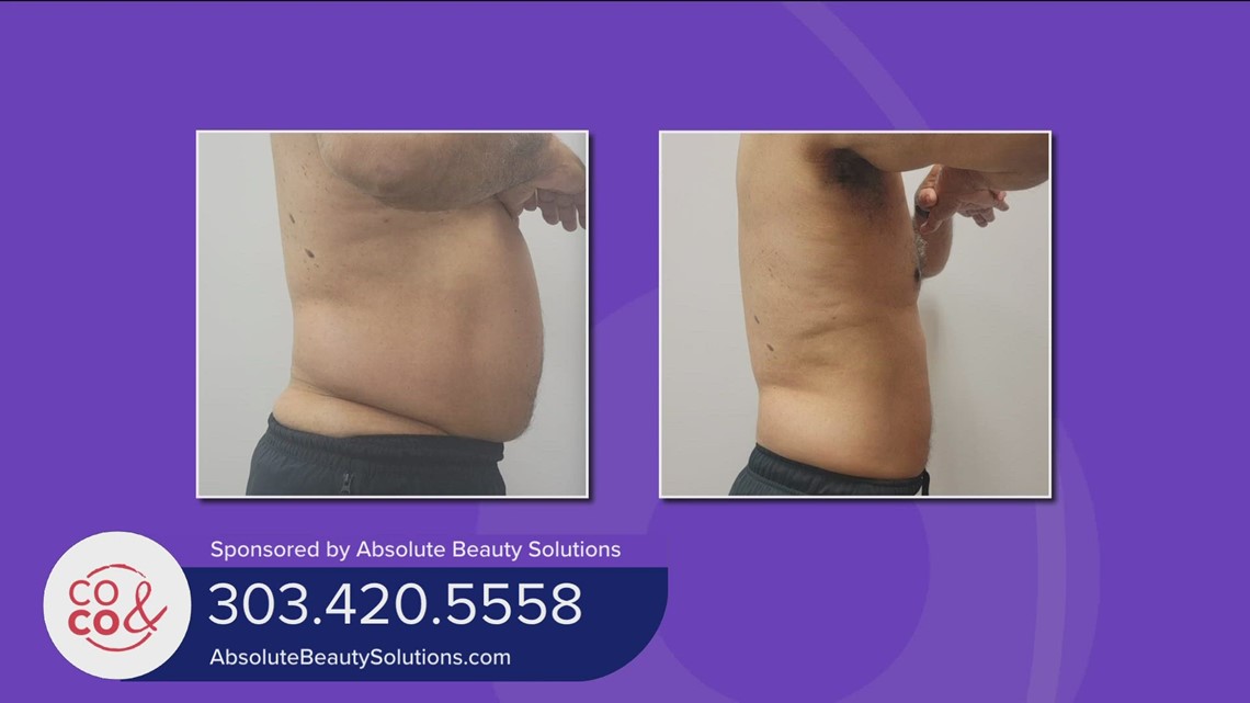 Absolute Beauty Solutions June 5, 2023