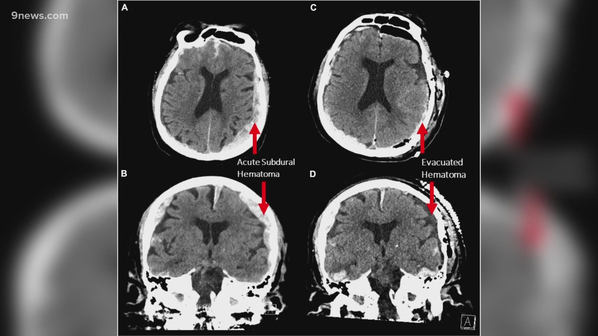 Do our lives really flash before our eyes in our final moments? Scientists are studying a man's brain scans to find out.