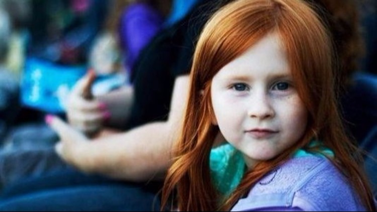 Redhead day is Nov. 5! 9 fun facts about red hair 