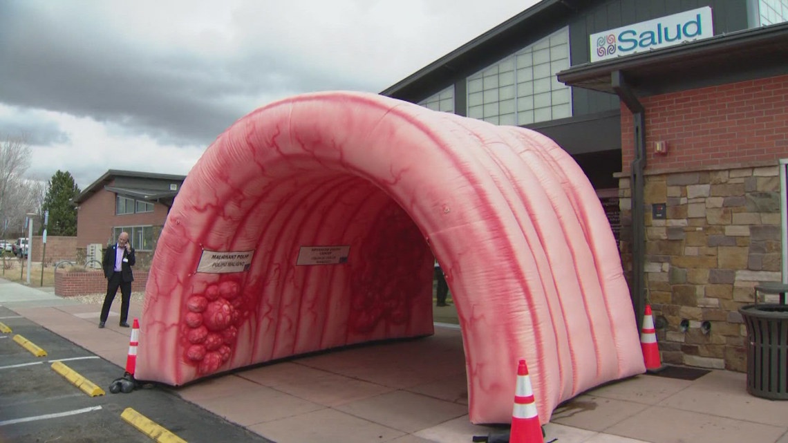 Giant walk-through colon raising colorectal cancer awareness at Longmont clinic - 9News