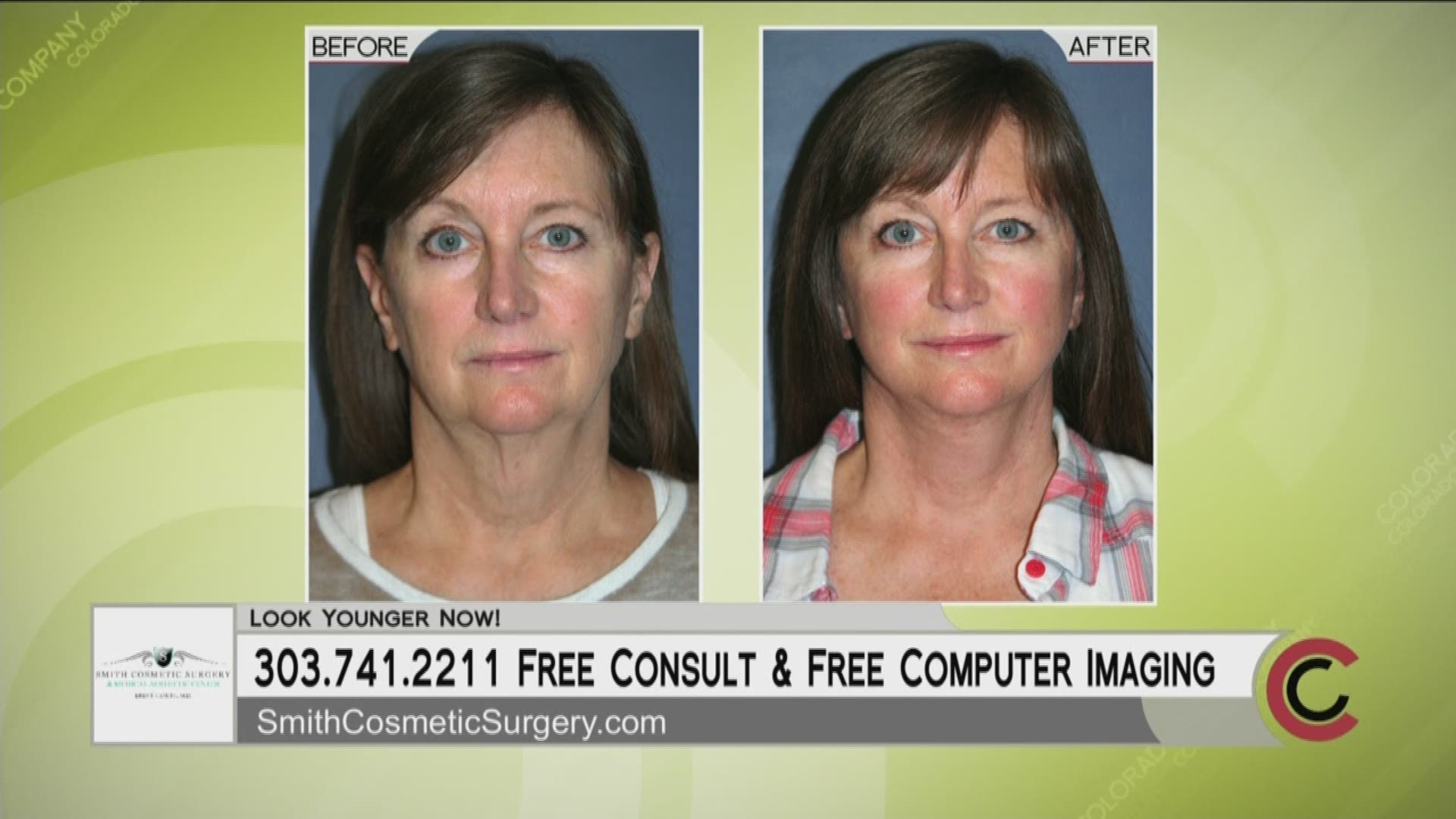 On your first visit to Smith Cosmetic Surgery, you'll get free computer imaging of your potential results. Learn more at 303.741.2211 or SmithCosmeticSurgery.com.