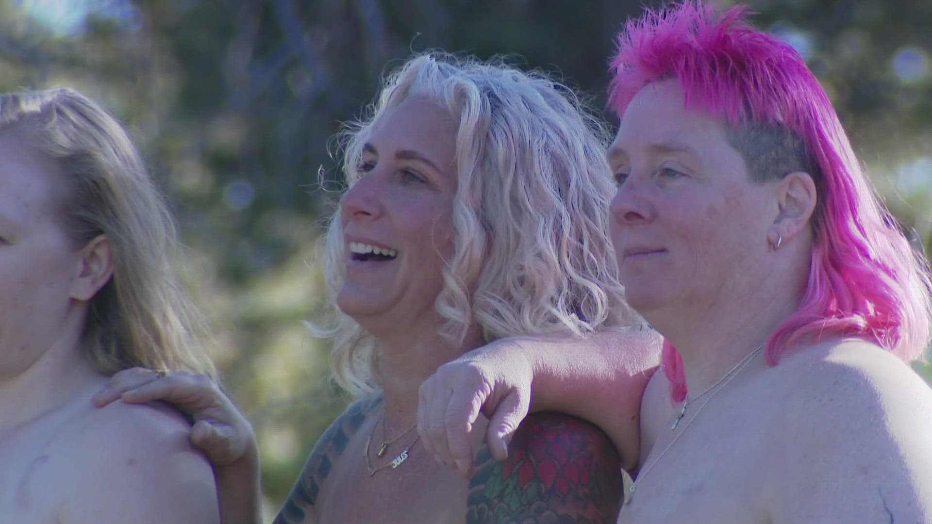 Breast cancer survivors show their scars to erase stigma