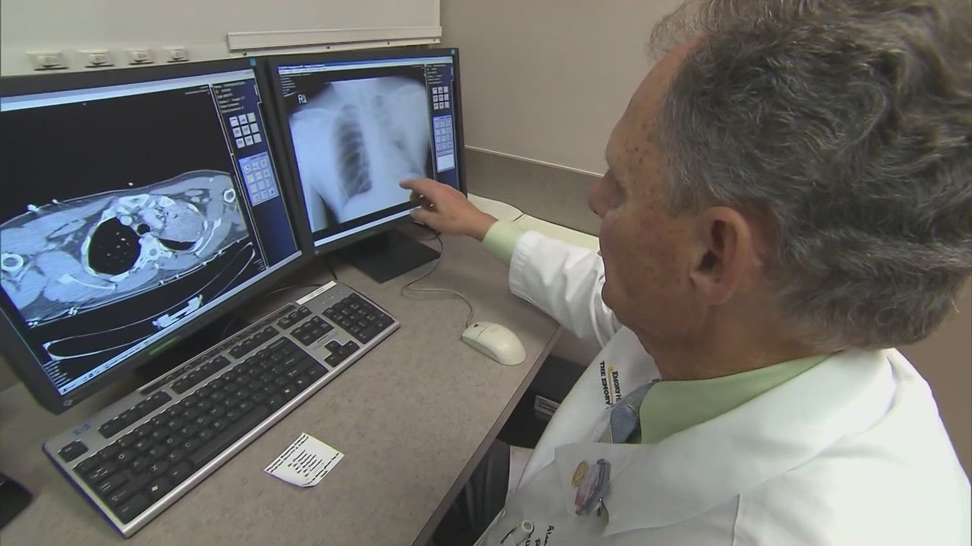 Medical expert Dr. Payal Kohli discusses a new at-home test that can help doctors screen for lung cancer.