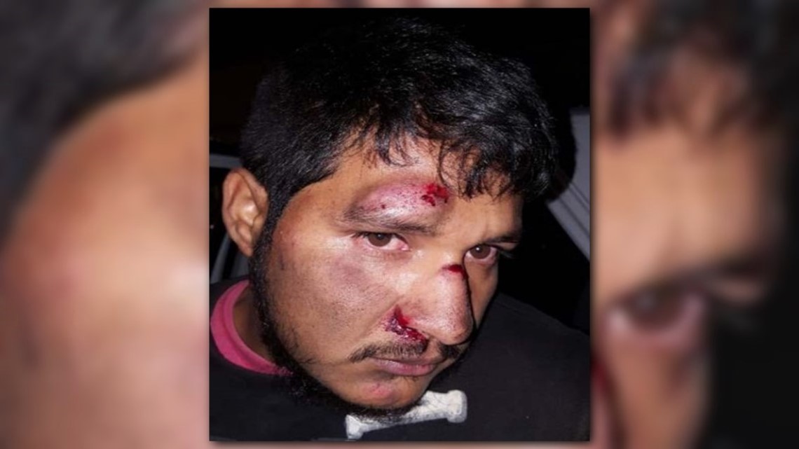 Aurora Police pay $285,000 settlement in brutality lawsuit - Vimarsana News