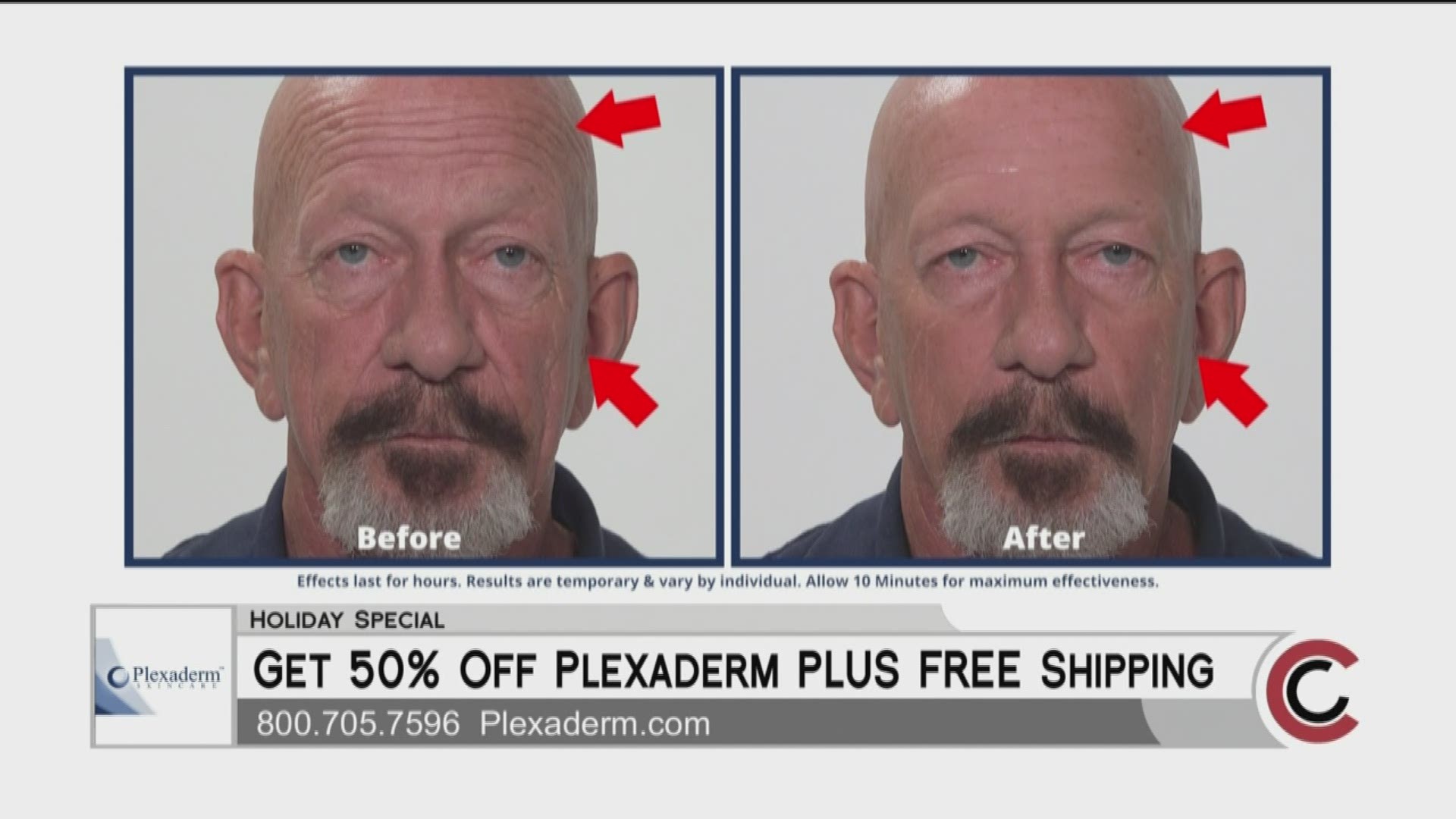 Get Plexaderm now during this great holiday special—50% off, plus free shipping! Order yours at Plexaderm.com or by calling 800.705.7596.