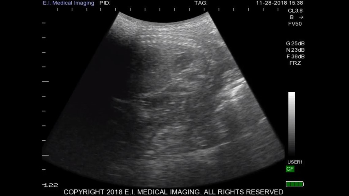 The Denver Zoo is expecting a baby sloth in February or March | 9news.com