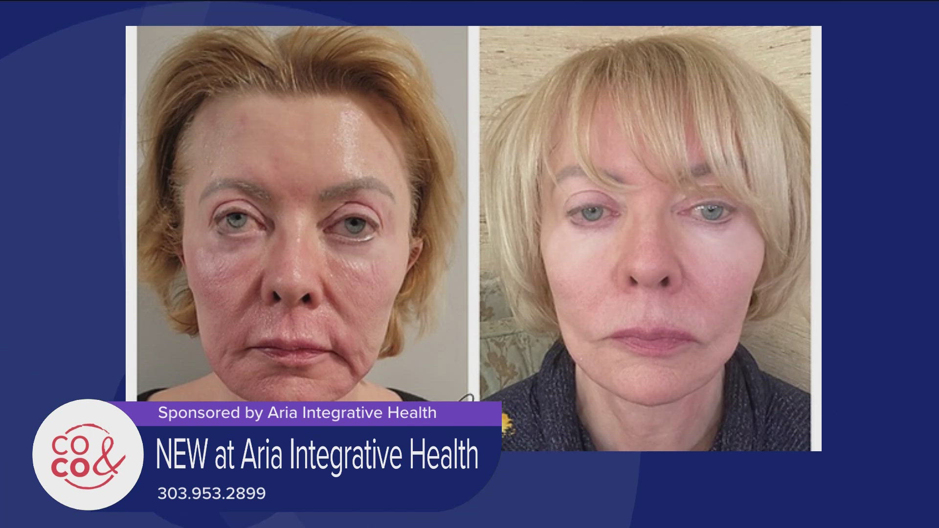 Revolutionary Facial Treatments at Aria Integrative Health