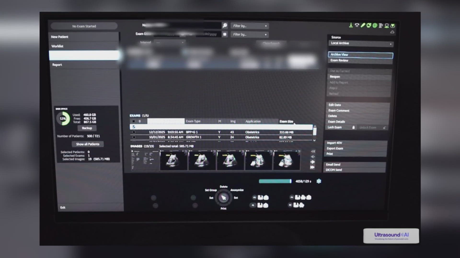 9news.com - Ryan Frazier - Business Buzz: Denver's AI prenatal breakthrough and Colorado's return to the moon