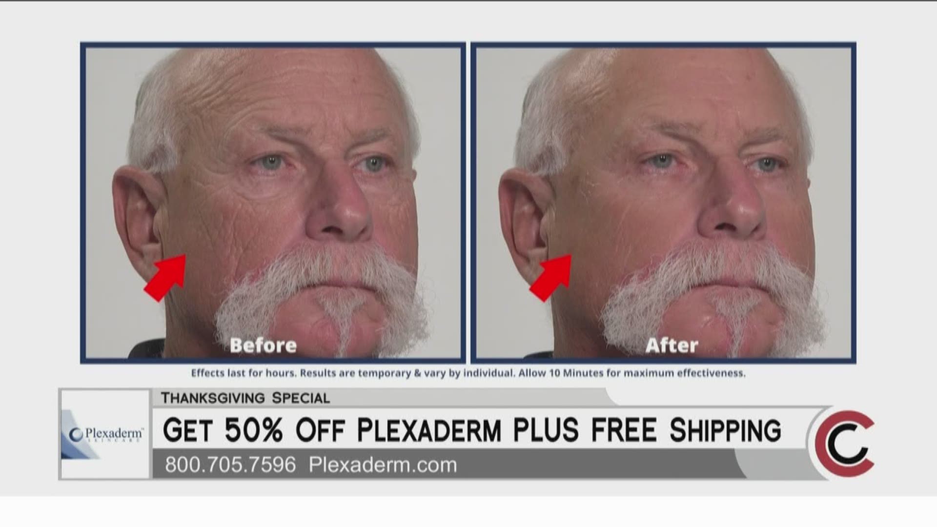 Take the 10-Minute Challenge and give Plexaderm a try. Right now you can get 50% off and free shipping! Call 800.705.7596, or visit www.Plexaderm.com.