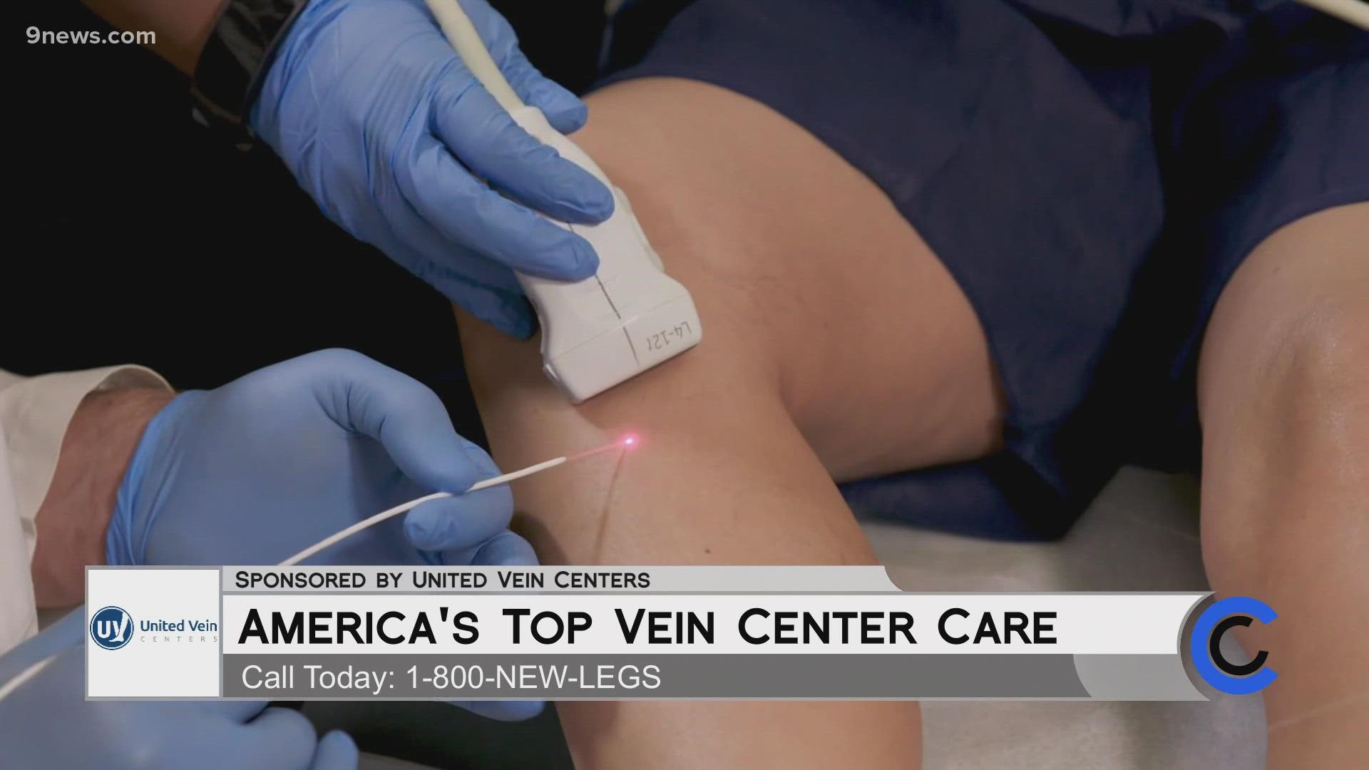 Call United Vein Centers at 1.800.NEW.LEGS to schedule your free vein screening. Learn more at UnitedVeinCenters.com. **PAID CONTENT**
