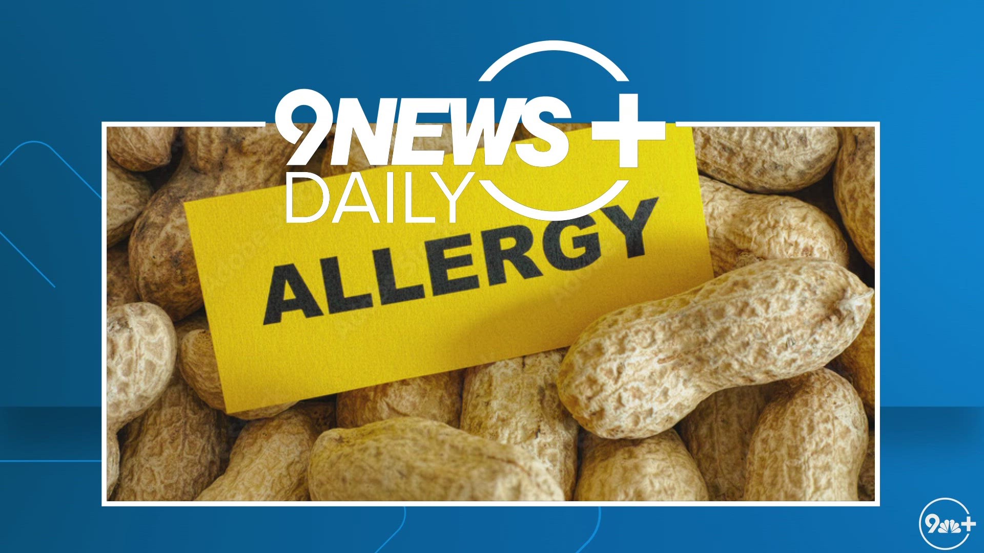 Severe peanut allergies impact thousands of toddlers across America. A new wearable patch could prevent severe reactions amongst toddlers. Dr. Payal Kohli explains.