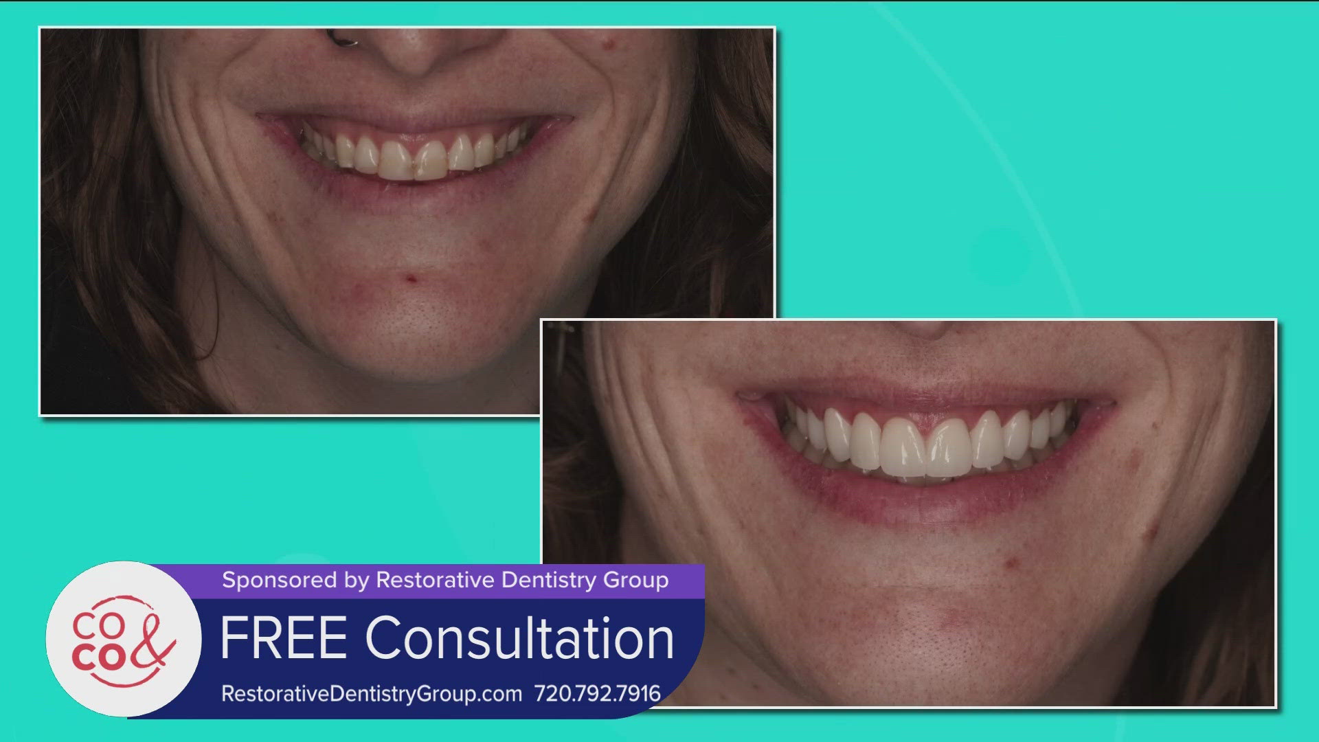 Restorative Dentistry Group uses the latest in smile tech and has a specialist at each of their 6 locations! Call 720.792.7916 or visit RestorativeDentistryGroup.com