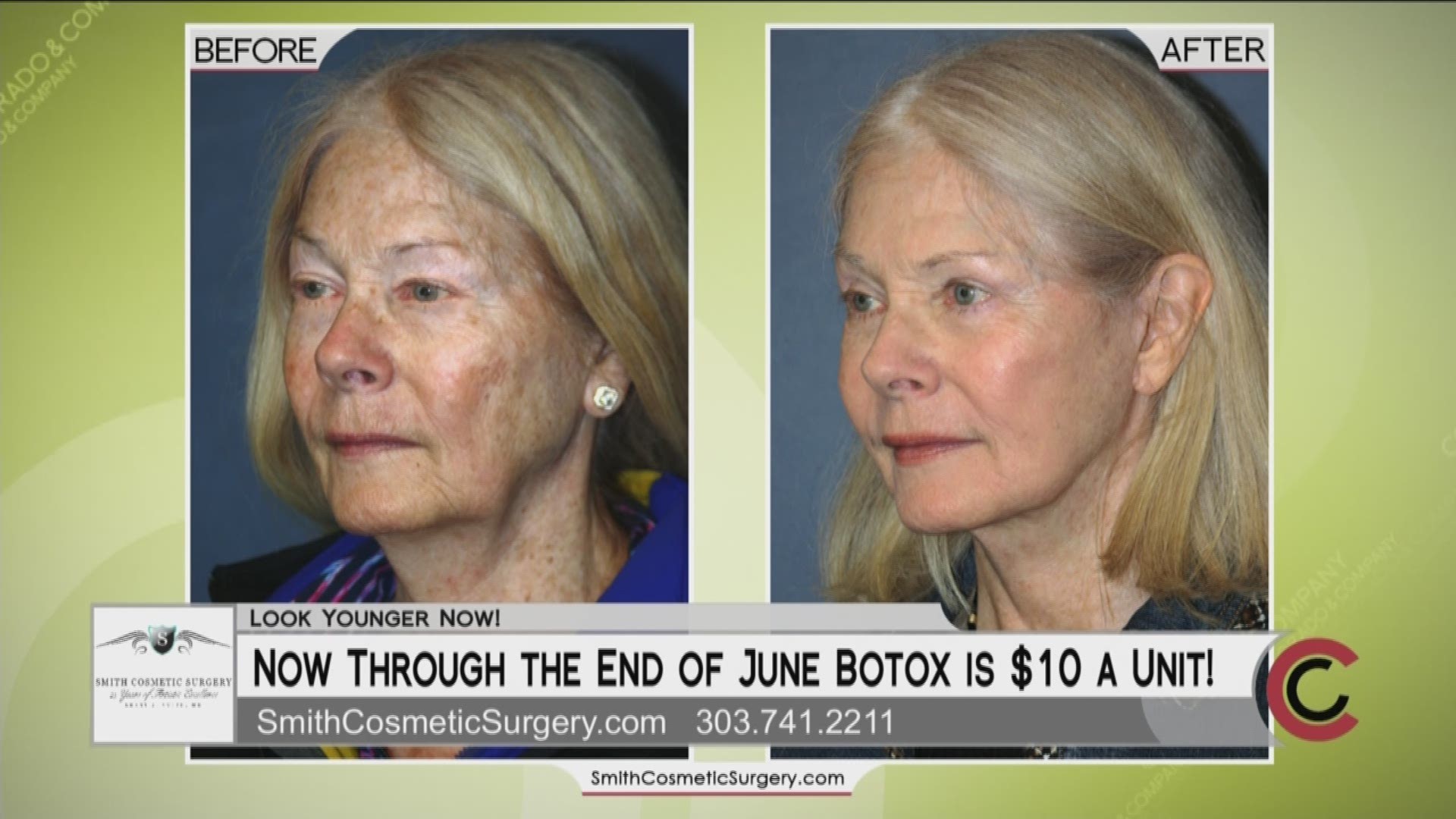 Make an informed choice for your facial cosmetic procedure. Dr. Brent Smith will develop the right plan for you and your budget. Initial consultations are free, as well as complimentary computer imaging to preview your potential results. $10 Botox treatments are going on through the end of June. Give them a call at 303.741.2211 or go online to www.SmithCosmeticSurgery.com. 
THIS INTERVIEW HAS COMMERCIAL CONTENT. PRODUCTS AND SERVICES FEATURED APPEAR AS PAID ADVERTISING.