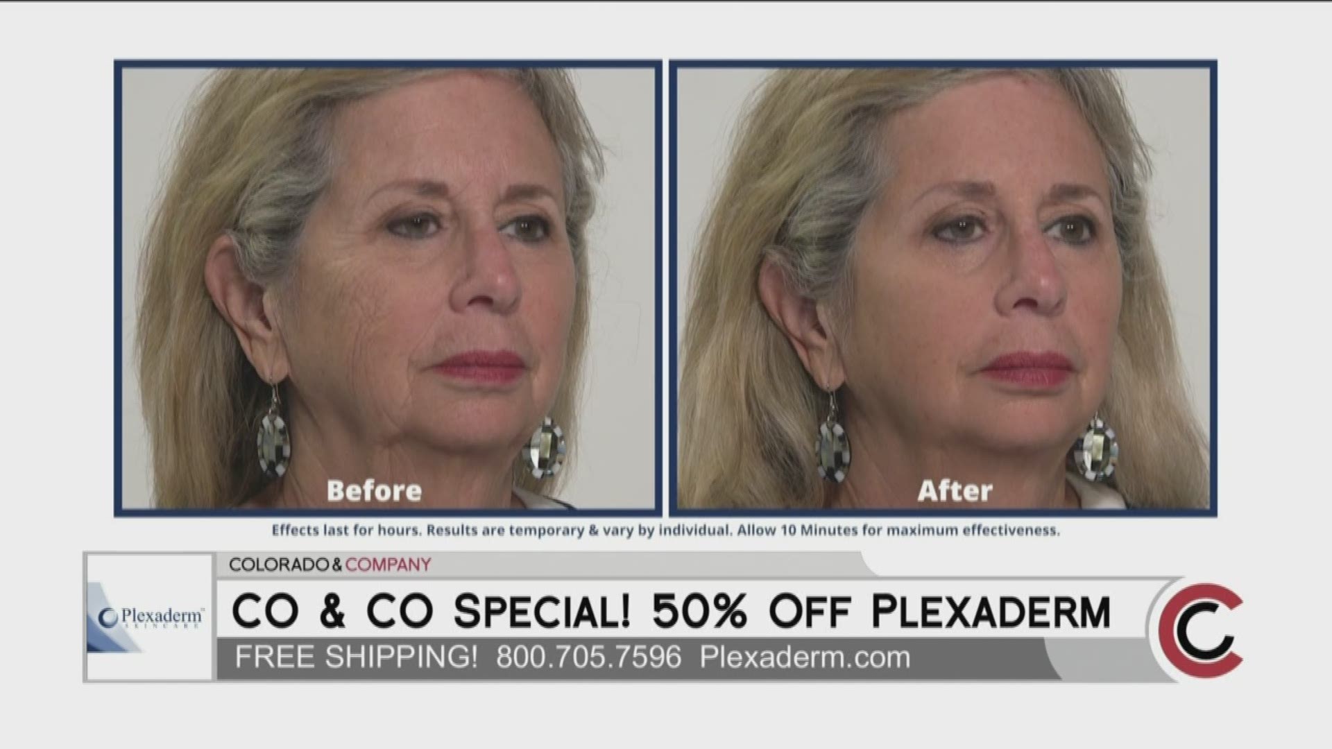 Colorado and Company viewers can get Plexaderm for up to 50% off with free shipping. Order yours online at www.Plexaderm.com
