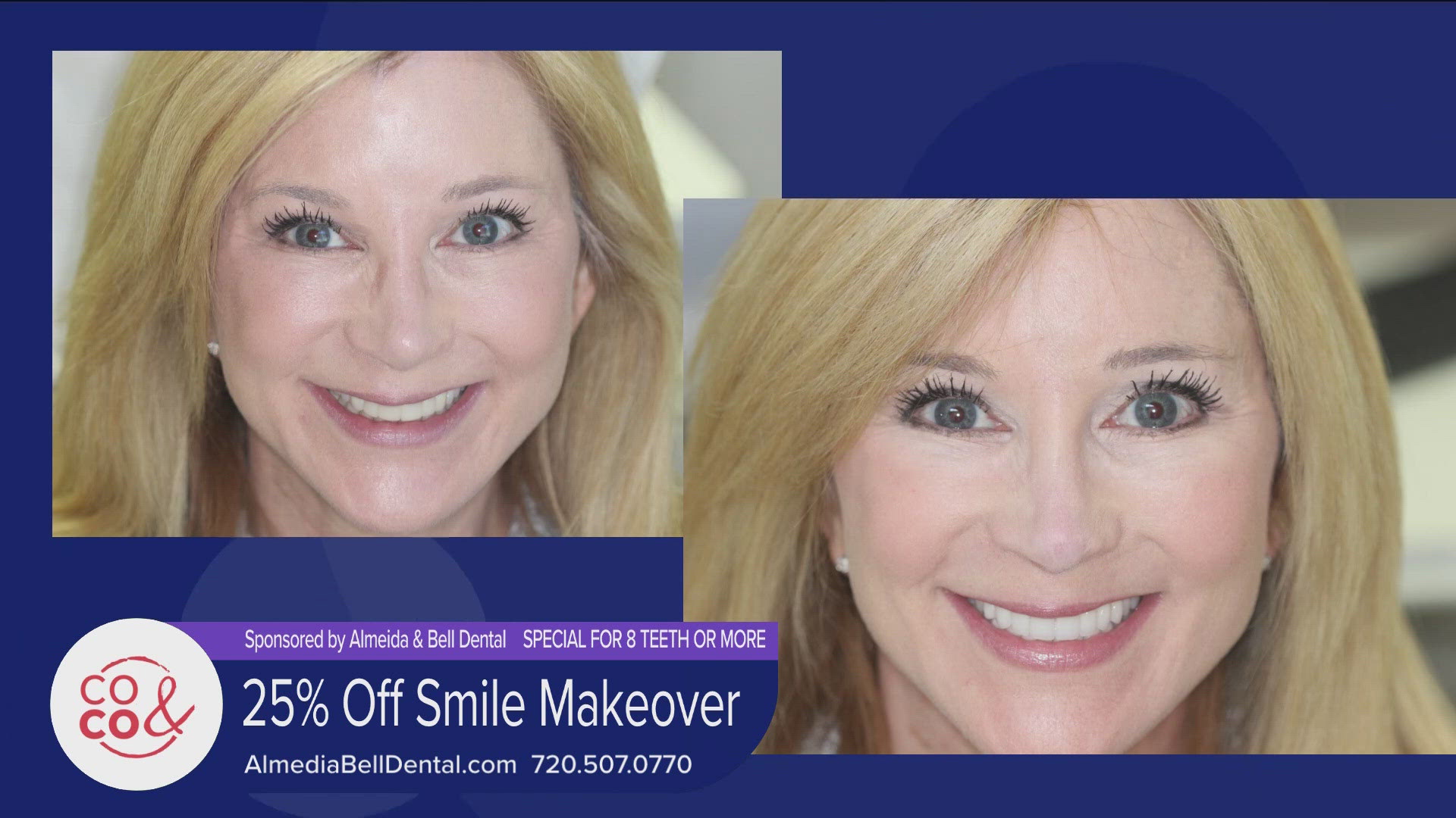 Call 720.507.0770 or visit AlmeidaBellDental.com to get started. Mention COCO and you can get 25% off a smile makeover of 8 teeth or more! **PAID CONTENT**