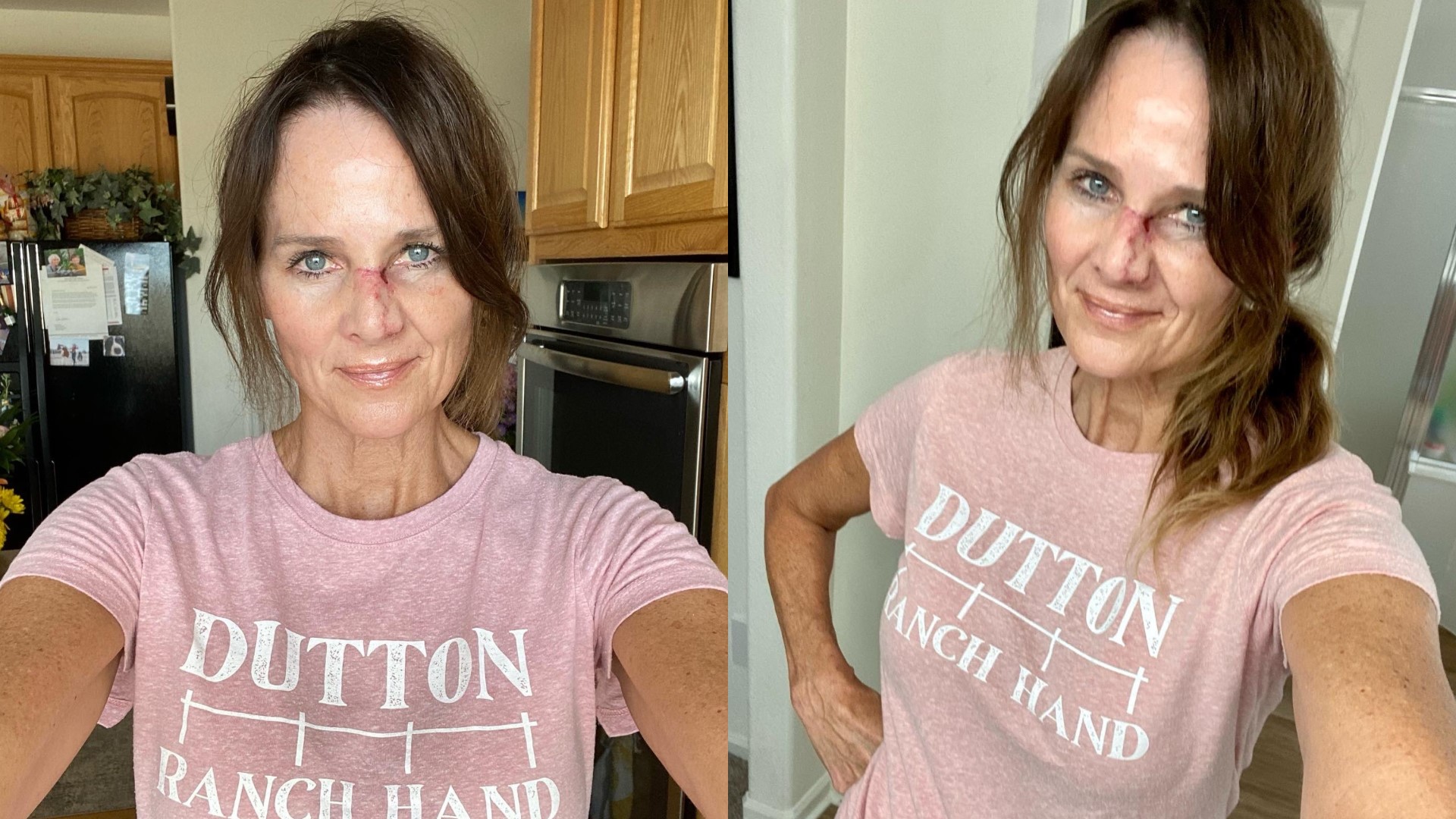 9NEWS Meteorologist Kathy Sabine shares her skin cancer story | 9news.com