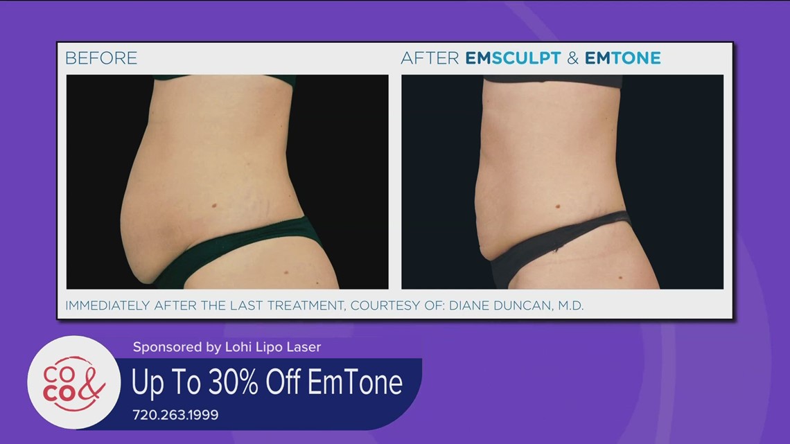 Lohi Lipo Laser June 28, 2023