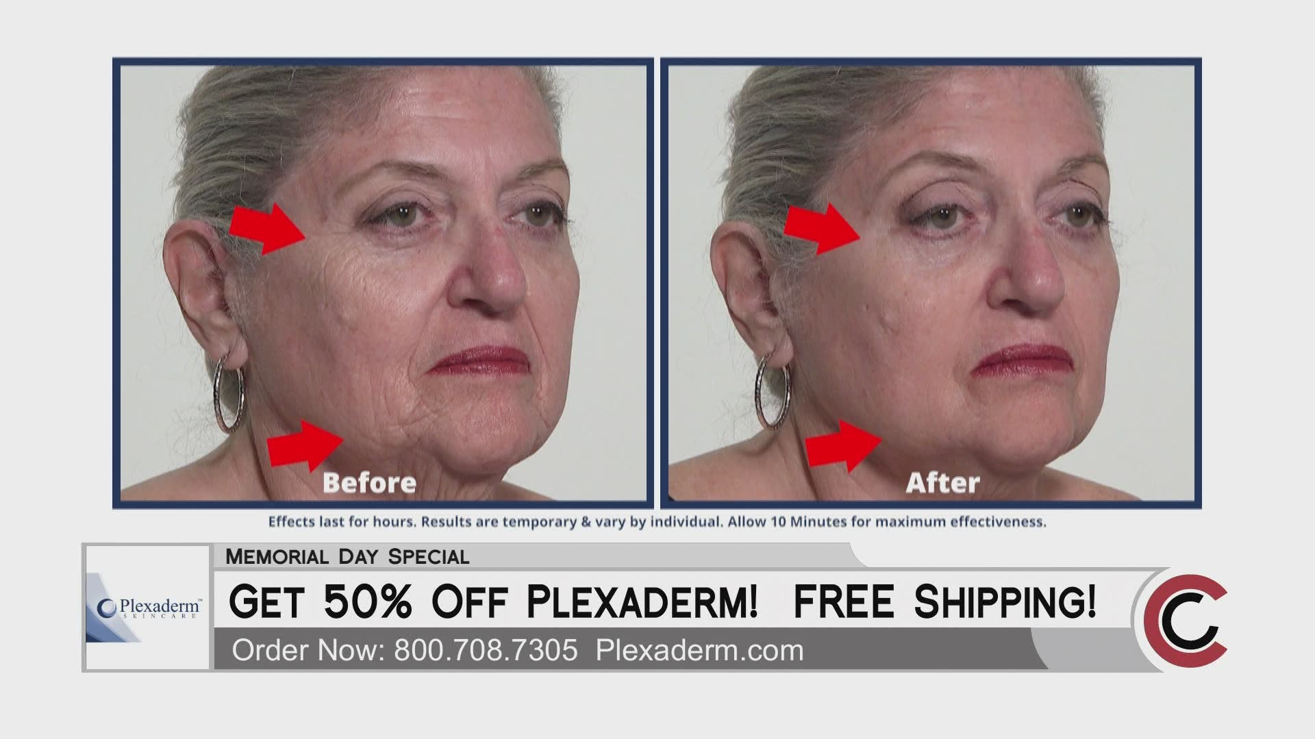 Get results in just minutes with Plexaderm. Call 800.708.7305 or visit Plexaderm.com to get 50% off with free shipping!