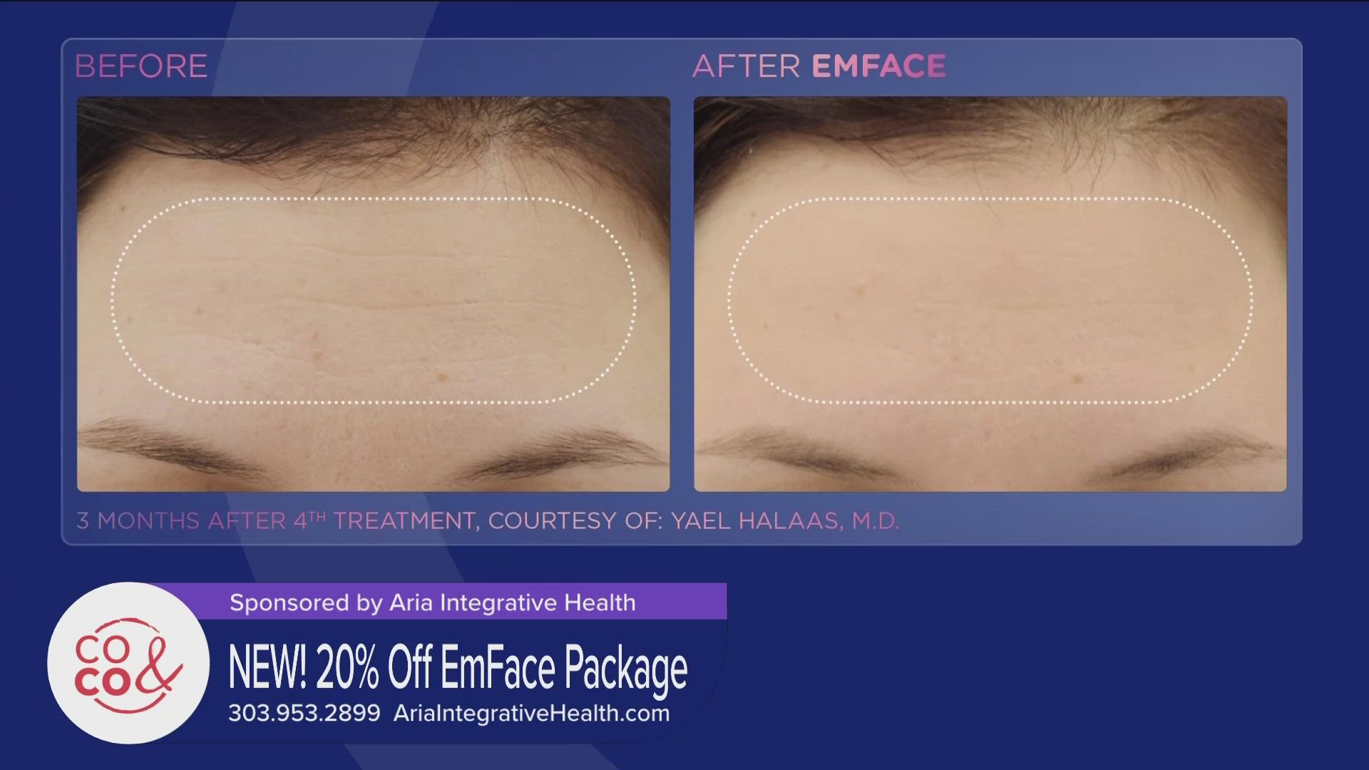 Call 303.953.2899 to get started with 20% off an EmFace Treatment Package and free consultation. Learn more at AriaIntegrativeHealth.com. **PAID CONTENT**