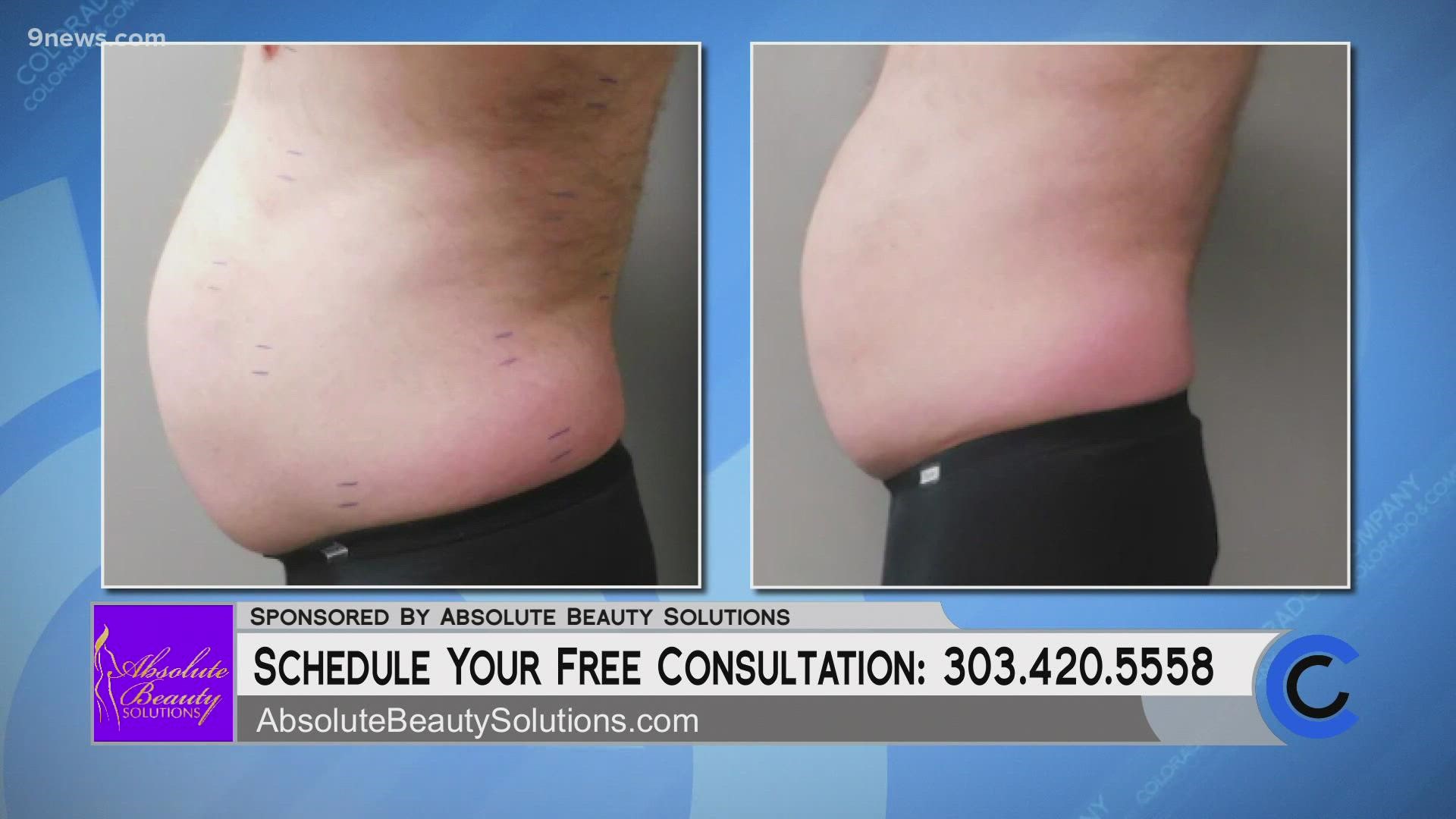 Lose two inches with ultra slim during your first visit or its free! Visit AbsoluteBeautySolutions.com or call 303.420.5558 to get started. **PAID CONTENT**
