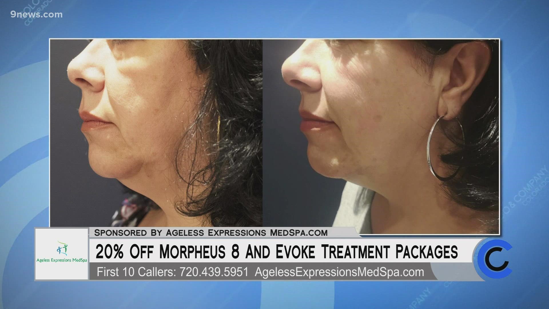 Ageless Expressions has 20% off for the first 10 callers to book a Morpheus 8 treatment! Call 720.439.5951 or visit AgelessExpressionsMedSpa.com. **PAID CONTENT**