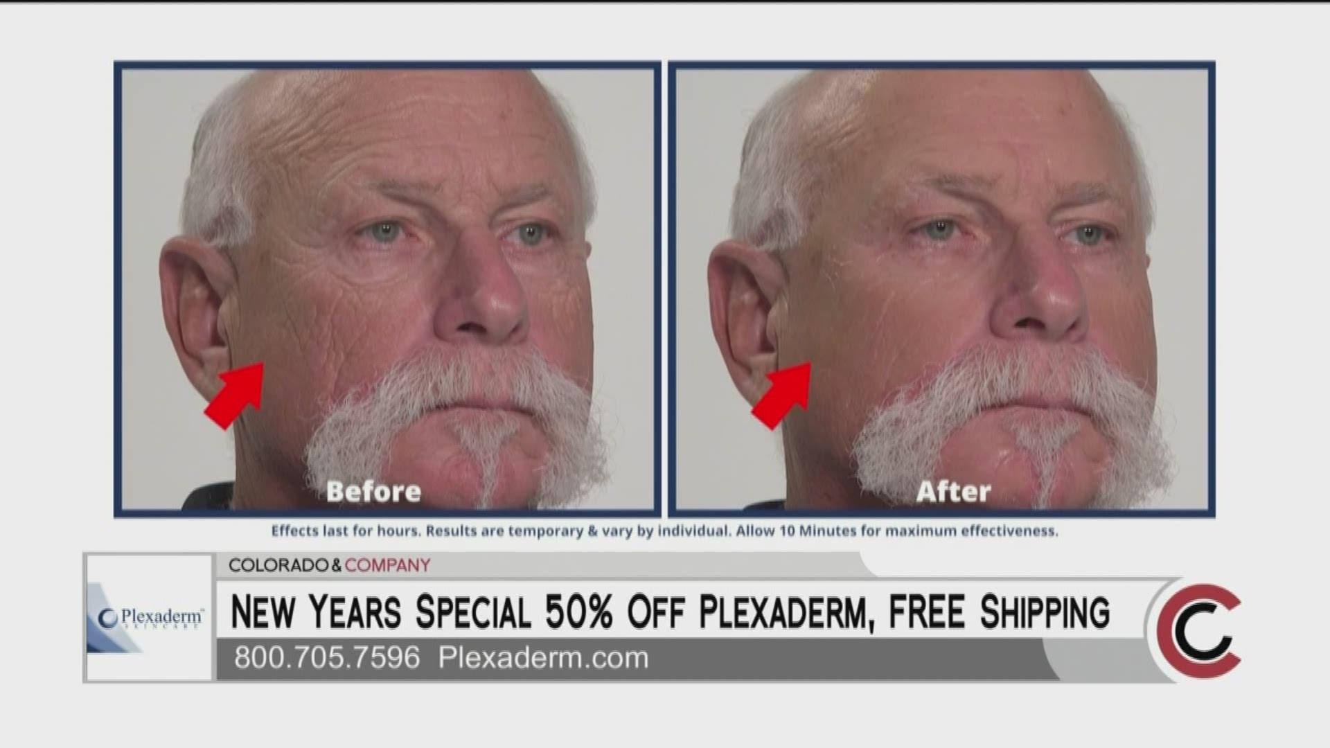 Call Plexaderm at 800.705.7596 and order yours today! Take advantage of 50% off and free shipping. Learn more at Plexaderm.com.