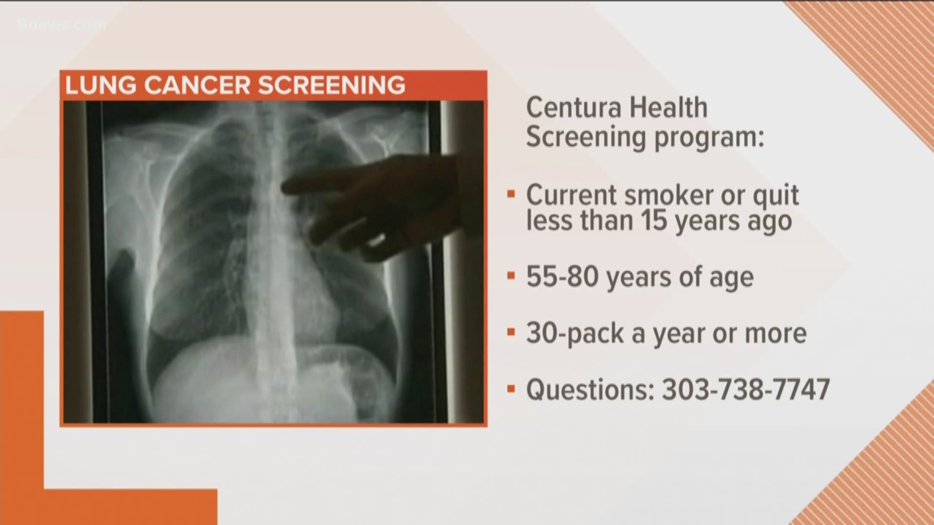 Dr. Nitin Gupta with Littleton Adventist Hospital wants screenings for lung cancer to be more common. He talks about risk factors and who should be screened.