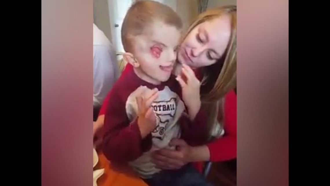 Baby born with no eyes lets mom see bigger picture