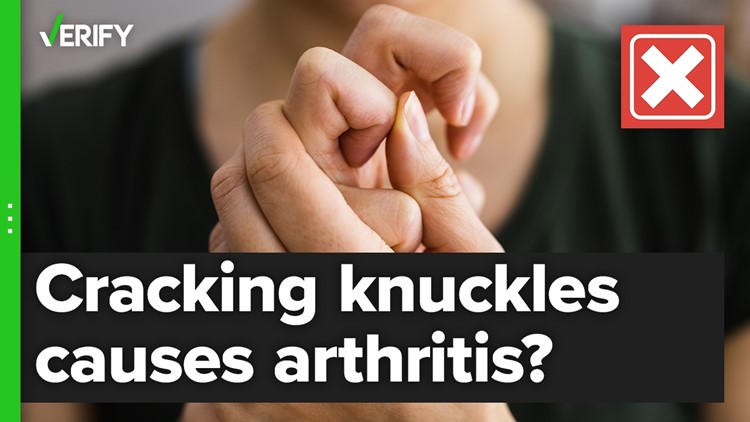 No, cracking your knuckles won’t cause arthritis