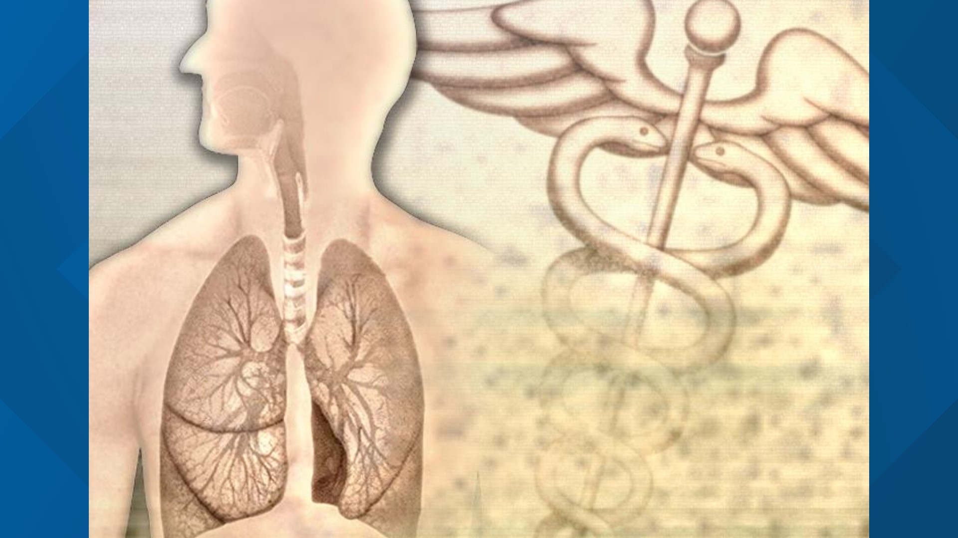 Should You Have a Lung Cancer Screening? | 9news.com