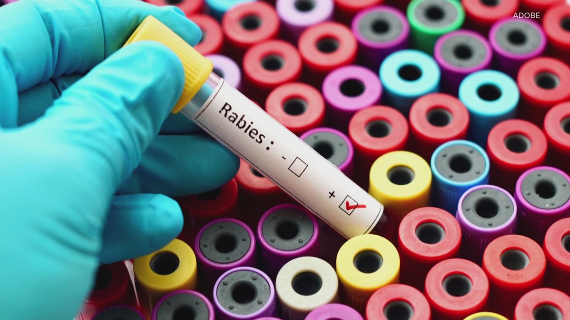 Michigan Rabies Michigan resident dies from rabies via organ transplant | 9news.com